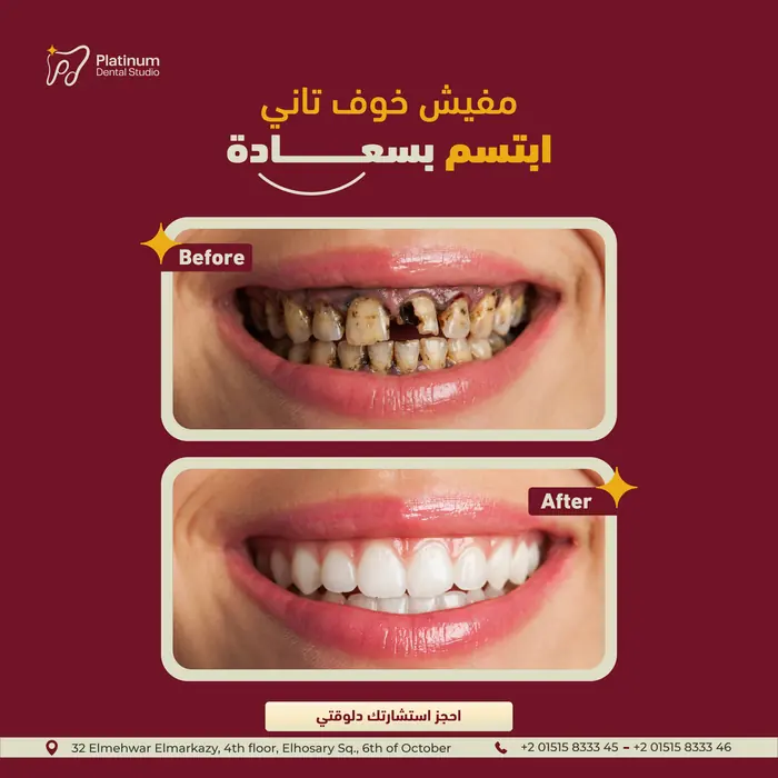 تصميم سوشيال لعيادة Platinum Dental Studio
